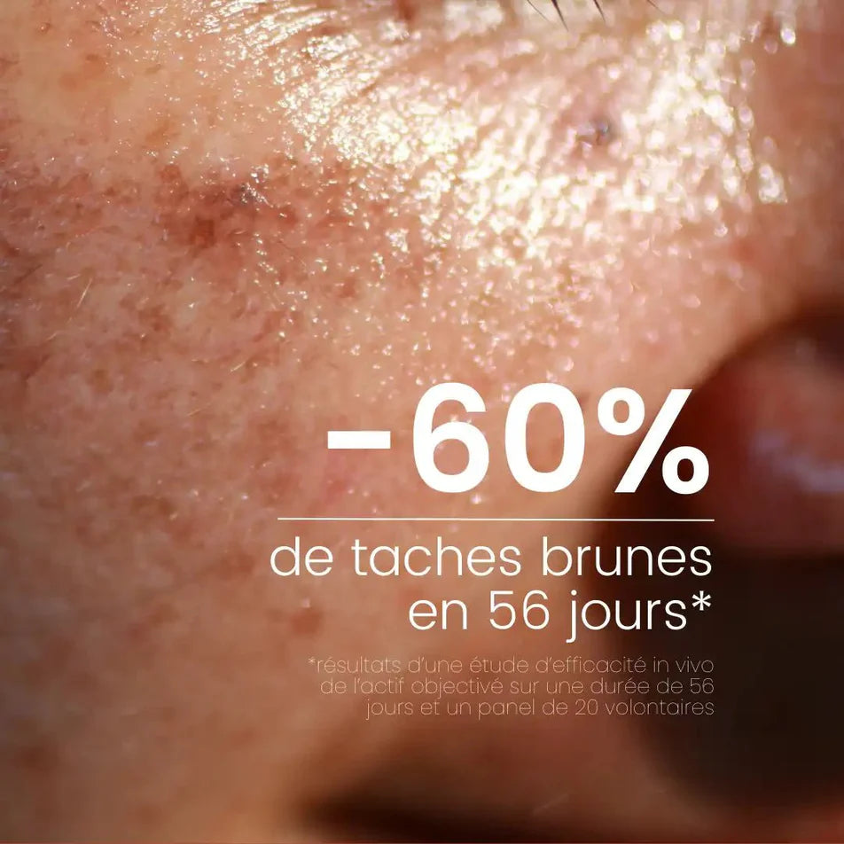 Sérum Anti-taches