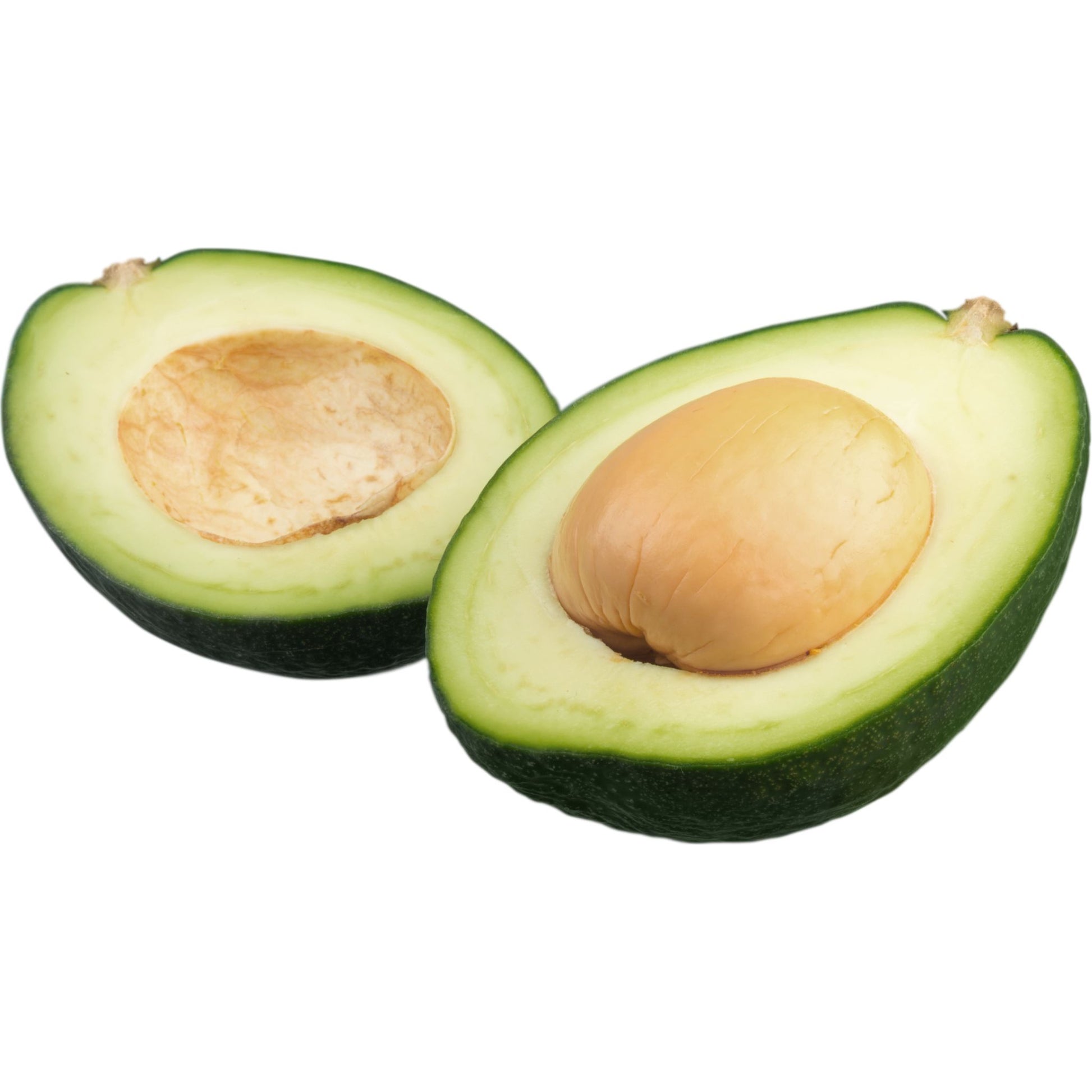 Avocat