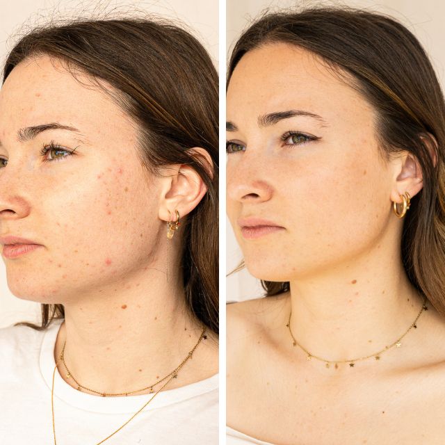 Sérum Anti-imperfections