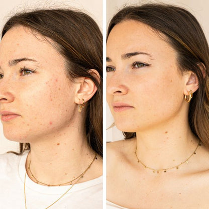 Sérum Anti-imperfections